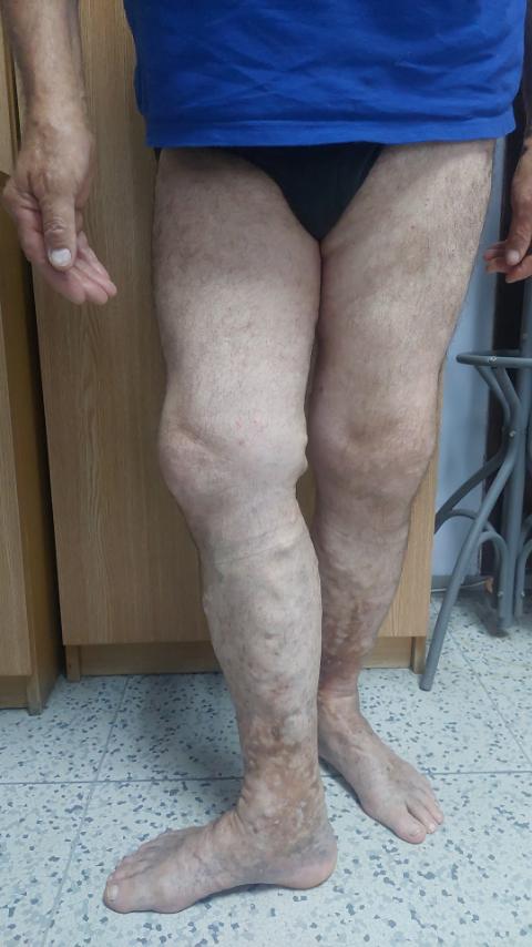 momcilo filipovski pre operacije 2