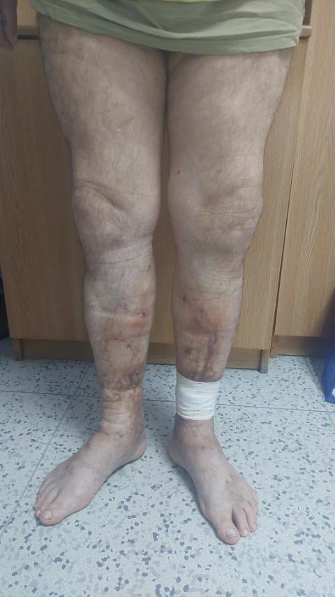 momcilo filipovski pre operacije 3