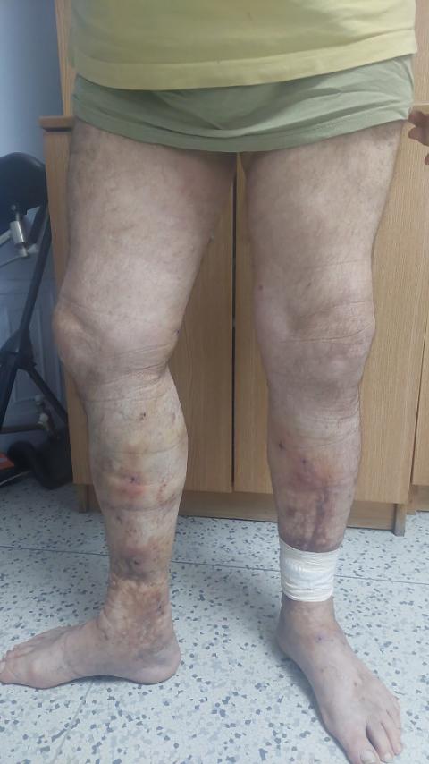 momcilo filipovski pre operacije 4